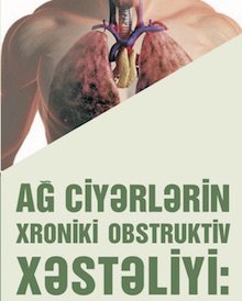 Ağciyərlərin Xroniki Obstruktiv Xəstəliyi